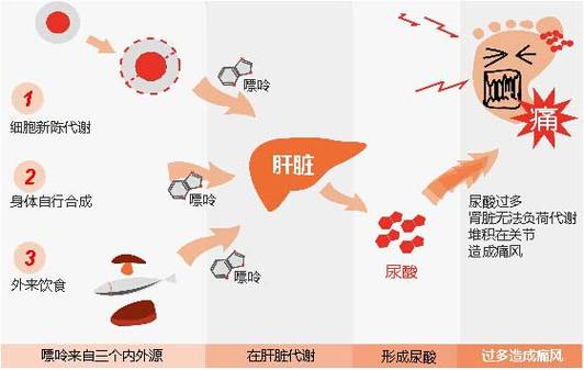 包含什么是尿酸尿酸是怎么形成的的词条