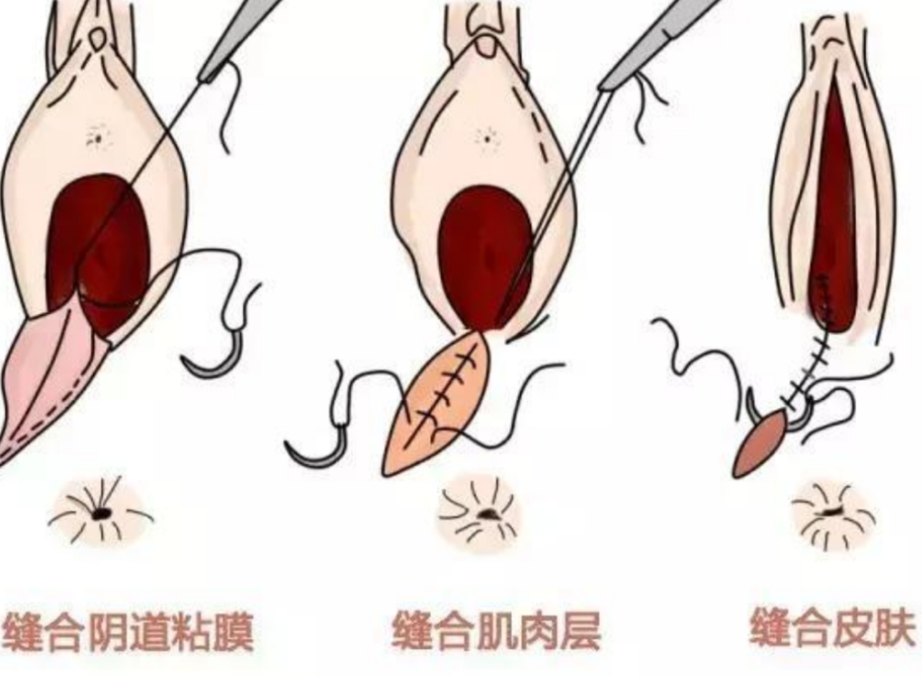 TG变性自动手术机器动画、TG变性自动手术机器动画完整版